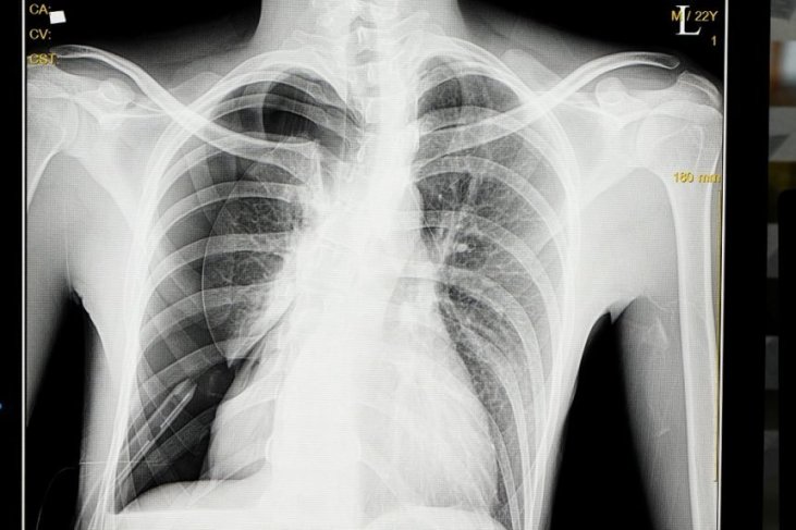 Proposal Usaha Budidaya Ikan Lele Lengkap