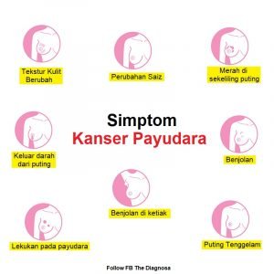 Kanser Payudara: Punca, Simptom Dan Rawatan - The Diagnosa